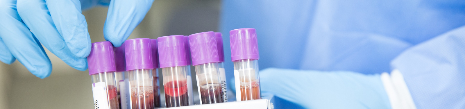 NOWOŚĆ – ODBIÓR WYNIKÓW LABORATORYJNYCH ONLINE